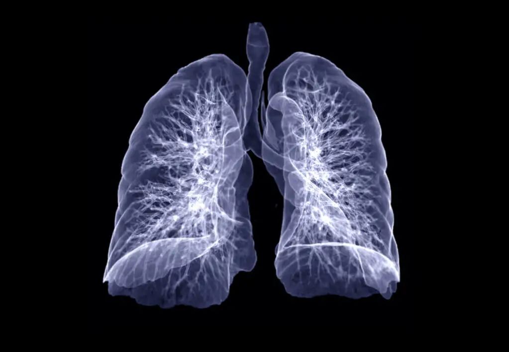 中医基础第二版12：肺，最容易受邪得病