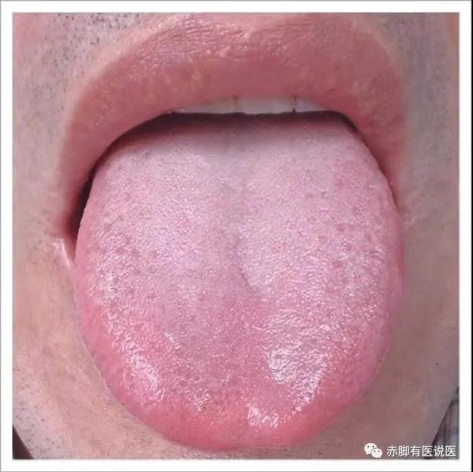 中医基础理论第15课，20分钟学会自己看舌像，读懂自己身体不求人！